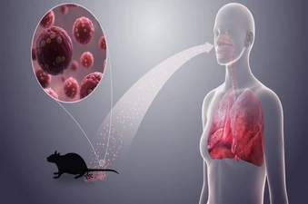 Bộ Y tế cảnh báo khẩn sau vụ 3 người tử vong do virus Hanta trên tàu du lịch
