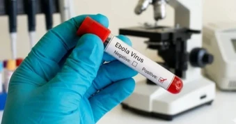 Bộ Y tế chỉ đạo khẩn ứng phó với bệnh do virus Ebola