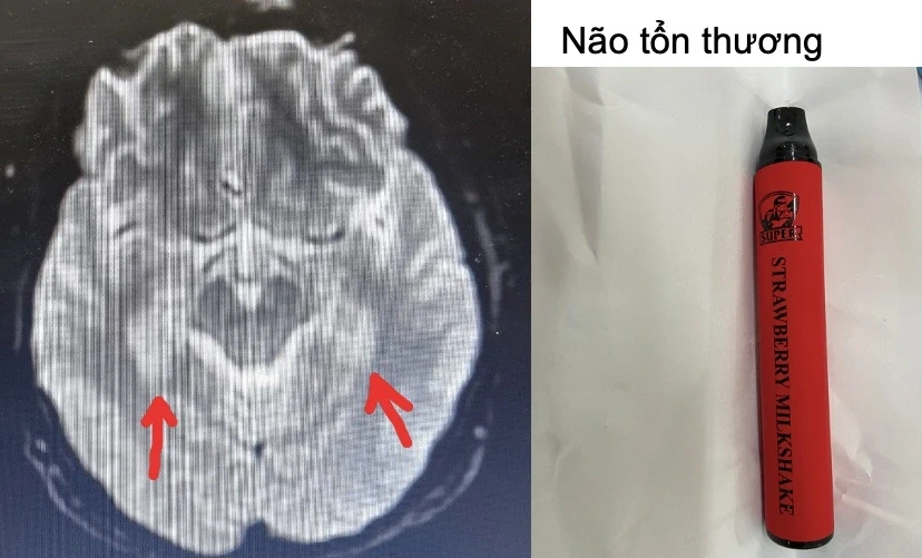 Bộ Y tế đề xuất cấm người sinh sau năm 2010 hút thuốc lá Bộ Y tế đề xuất cấm người sinh sau năm 2010 hút thuốc lá