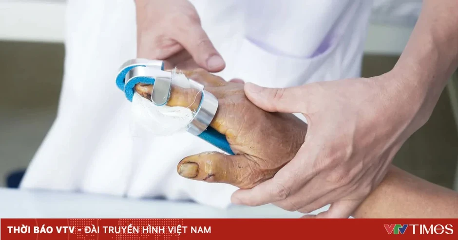 Bỏng nặng do điện thoại phát nổ khi đang sạc