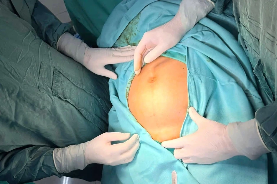 Bụng to nhanh bất thường, người phụ nữ phát hiện khối u tử cung nặng 3kg