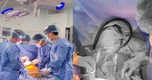 Ca cấy ghép thiết bị hỗ trợ tim CorHeart 6 đầu tiên tại Việt Nam
