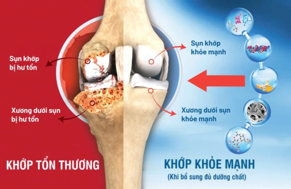 Cách giảm đau khớp ở người lớn tuổi - Báo TinVina Cách giảm đau khớp ở người lớn tuổi - Báo TinVina