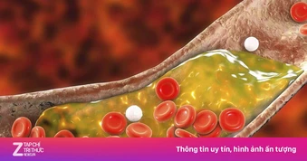 Cách hạ mỡ máu tự nhiên, càng duy trì càng hiệu quả