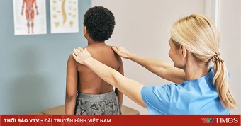 Cách nhận biết sớm vẹo cột sống ở trẻ