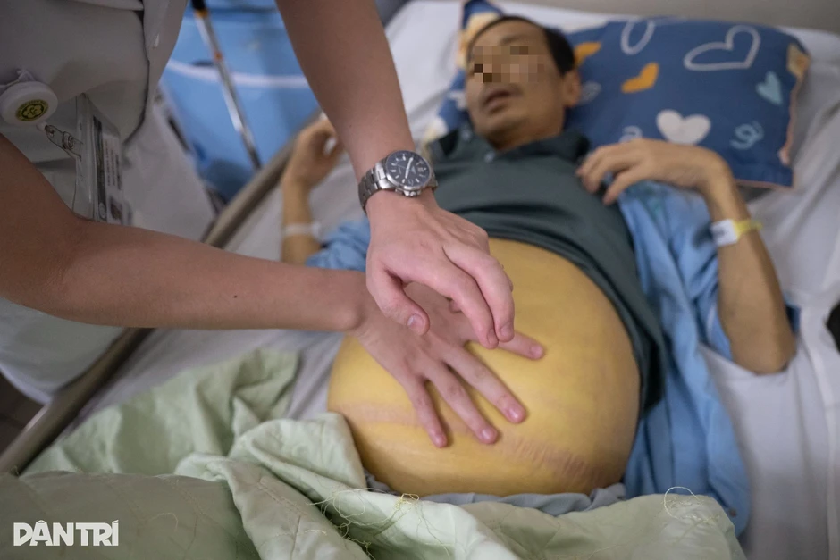 Căn bệnh hơn 7 triệu người Việt mắc, là mầm mống ung thư gan Căn bệnh hơn 7 triệu người Việt mắc, là mầm mống ung thư gan