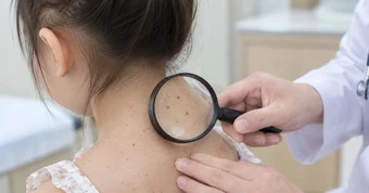 Căn bệnh khiến ánh nắng trở thành 'kẻ thù', nguy cơ ung thư tăng gấp nghìn lần
