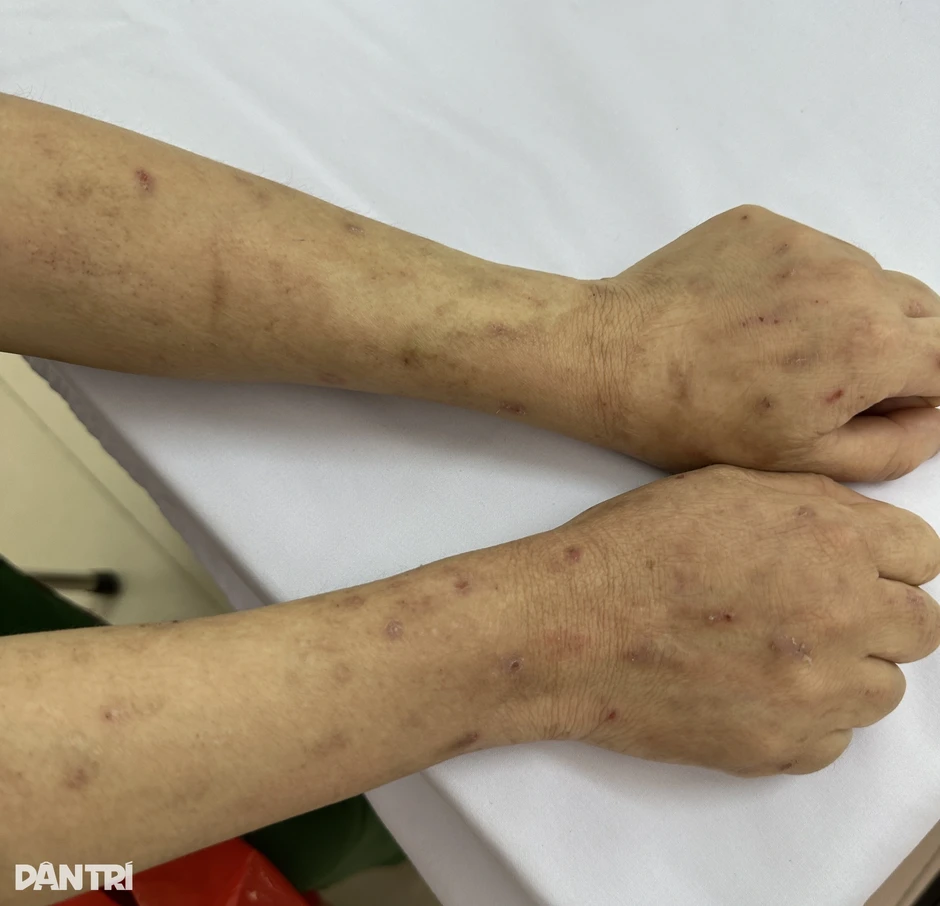 Căn bệnh khiến nghệ sĩ Chí Trung mất ngủ: Nhiều người mắc vì thói quen Căn bệnh khiến nghệ sĩ Chí Trung mất ngủ: Nhiều người mắc vì thói quen