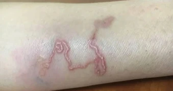 Căn bệnh khiến nghệ sĩ Chí Trung mất ngủ: Nhiều người mắc vì thói quen