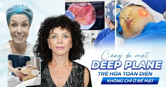Căng da mặt Deep Plane - Trẻ hóa toàn diện không chỉ ở bề mặt