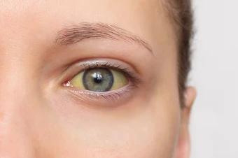 Cảnh báo 4 dấu hiệu của loại ung thư "sát thủ thầm lặng": Nếu có phải đi khám ngay