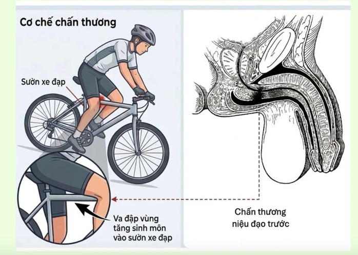 Cảnh báo chấn thương tiềm ẩn nguy hiểm ở trẻ em sau tai nạn tưởng chừng nhẹ Cảnh báo chấn thương tiềm ẩn nguy hiểm ở trẻ em sau tai nạn tưởng chừng nhẹ
