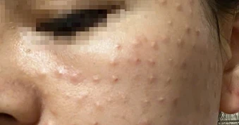 Cảnh báo lạm dụng thẩm mỹ theo mạng xã hội