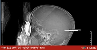Cảnh báo nguy cơ chấn thương khi tham gia lễ hội