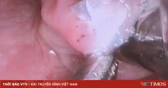 Cảnh báo nguy hiểm từ đồ chơi nam châm