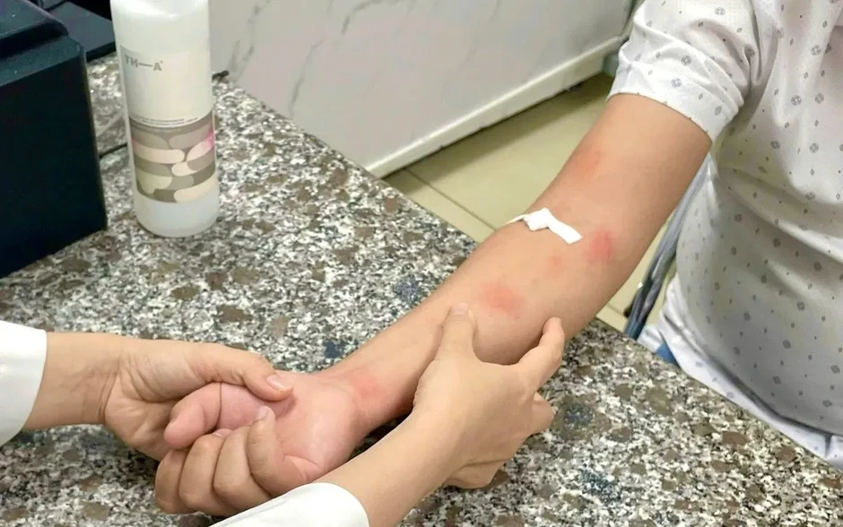 Cảnh báo nhiễm giun sán chó mèo gây bệnh da liễu Cảnh báo nhiễm giun sán chó mèo gây bệnh da liễu