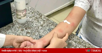 Cảnh báo nhiễm giun sán chó mèo gây bệnh da liễu