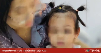 Cấp cứu kịp thời, bảo toàn khuôn mặt cho bé gái bị chó cắn