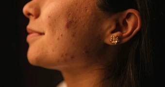 Chăm sóc da ngày Tết như thế nào?