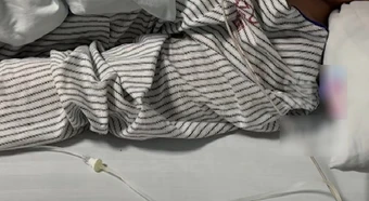 Chàng trai 30 tuổi mắt phải bỗng bị mờ, đi khám bác sĩ kết luận: Hệ miễn dịch đã bị tổn hại hoàn toàn