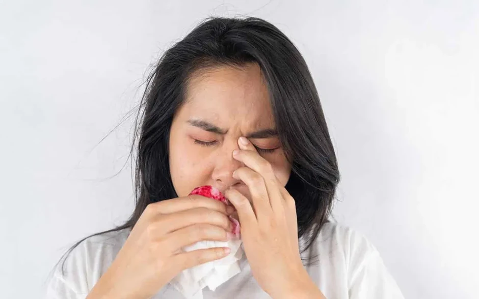 Chảy máu cam mùa nắng nóng: Xử trí sai dễ gây biến chứng Chảy máu cam mùa nắng nóng: Xử trí sai dễ gây biến chứng