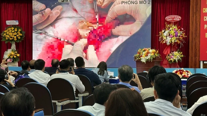 Chia sẻ kinh nghiệm nâng cấp "bản lĩnh đàn ông" Chia sẻ kinh nghiệm nâng cấp "bản lĩnh đàn ông"