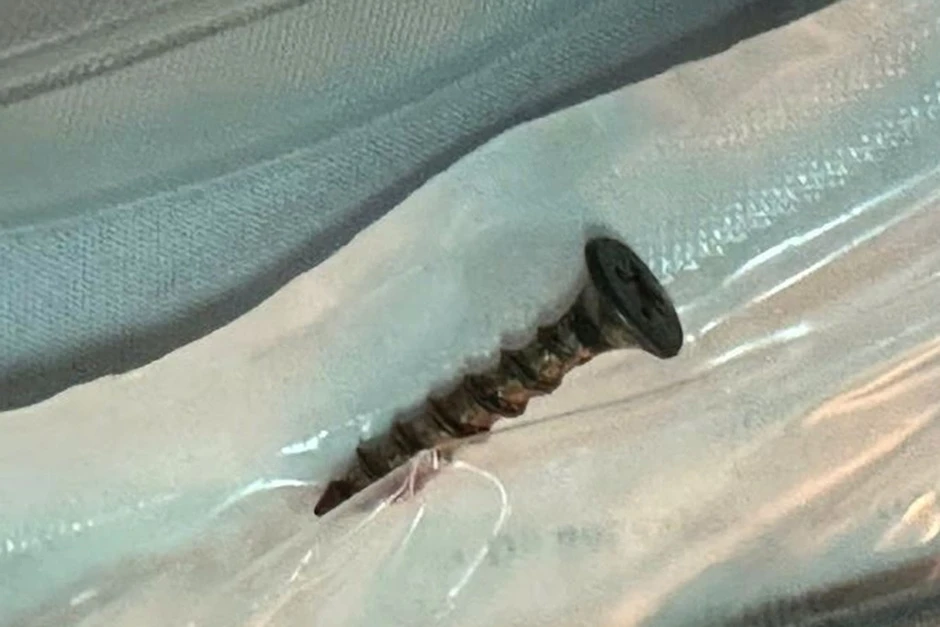 Chiếc đinh vít dài 4 cm trong đường thở bé trai Chiếc đinh vít dài 4 cm trong đường thở bé trai