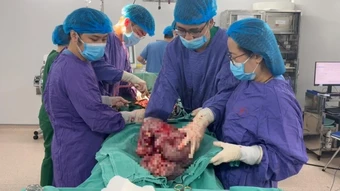 Chủ quan, người bệnh để khối u âm thầm phát triển chiếm gần hết ổ bụng