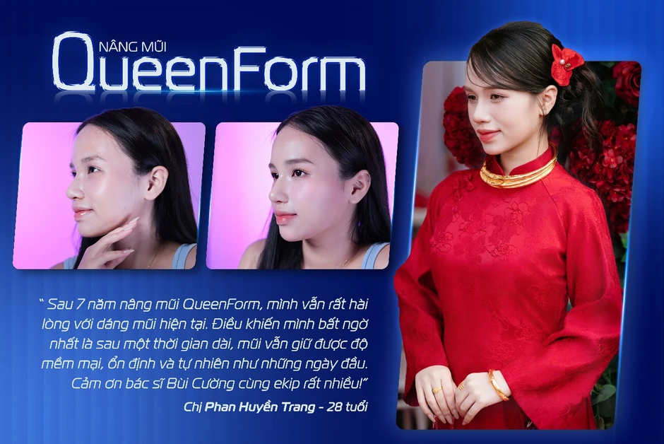 Chuyên gia chia sẻ giải pháp tái cấu trúc mũi lỗi hỏng sau nâng Chuyên gia chia sẻ giải pháp tái cấu trúc mũi lỗi hỏng sau nâng