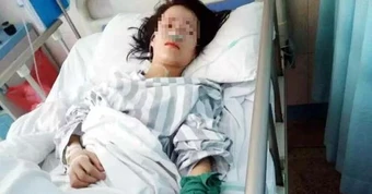 Cô gái 24 tuổi máu "ngập đường", phổi và thận đều tổn thương: Tại 4 thói quen từ thời tiểu học