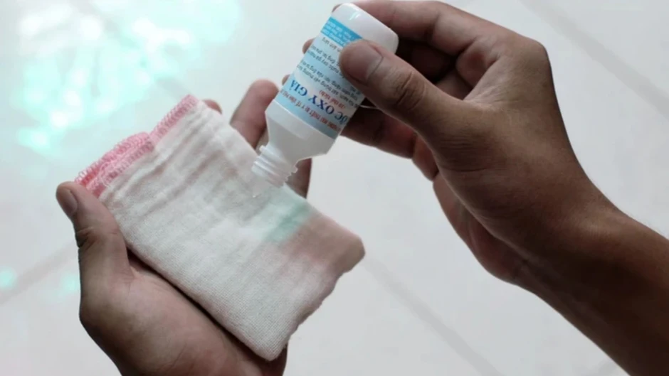 Có nên dùng oxy già để sát trùng vết thương thông thường? Có nên dùng oxy già để sát trùng vết thương thông thường?