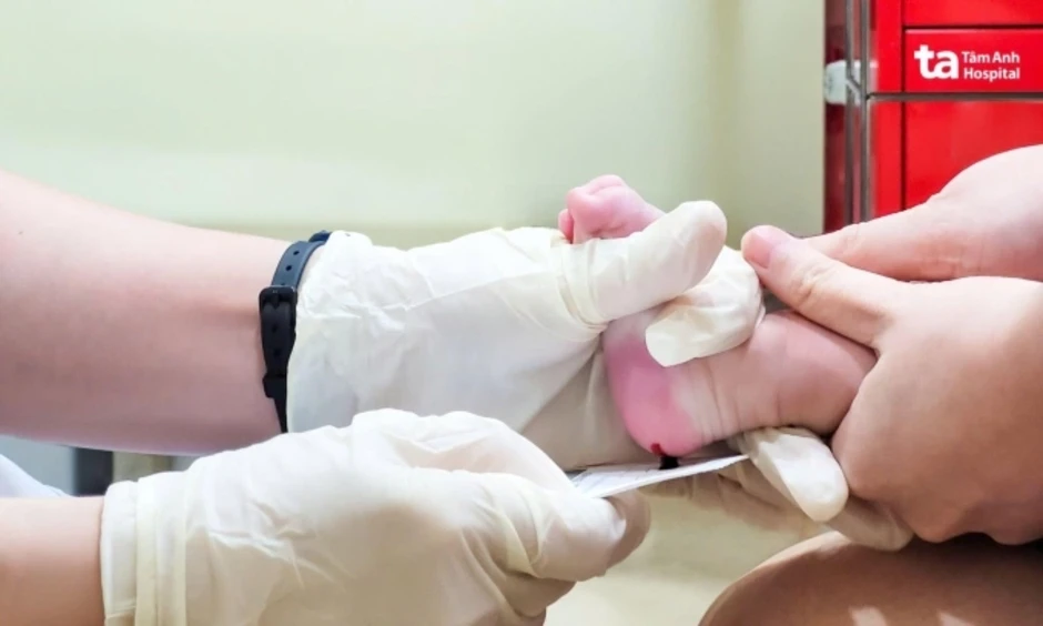 Có nên xét nghiệm máu gót chân cho trẻ sơ sinh không? - Báo TinVina Có nên xét nghiệm máu gót chân cho trẻ sơ sinh không? - Báo TinVina