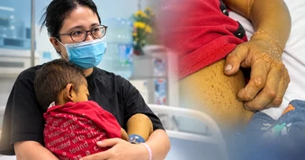 Con 4 tuổi da vàng như nghệ phải thay gan: Mẹ “sốc” khi biết căn bệnh phía sau