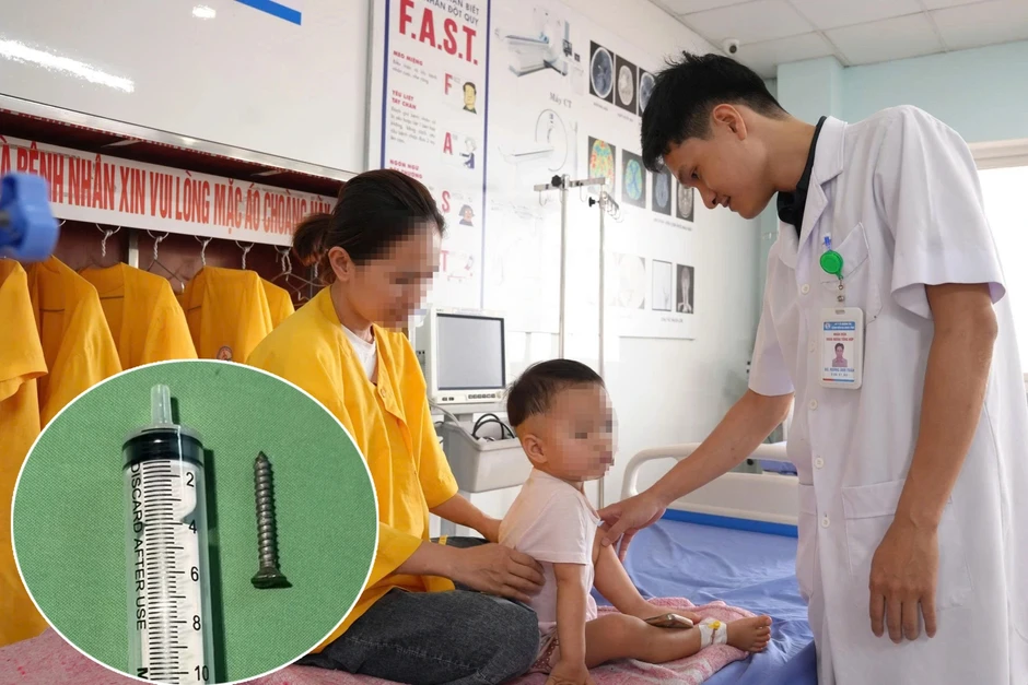 Con nuốt đinh vít, mẹ vỗ lưng khiến dị vật trôi sâu vào dạ dày Con nuốt đinh vít, mẹ vỗ lưng khiến dị vật trôi sâu vào dạ dày