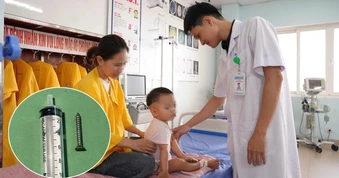 Con nuốt đinh vít, mẹ vỗ lưng khiến dị vật trôi sâu vào dạ dày