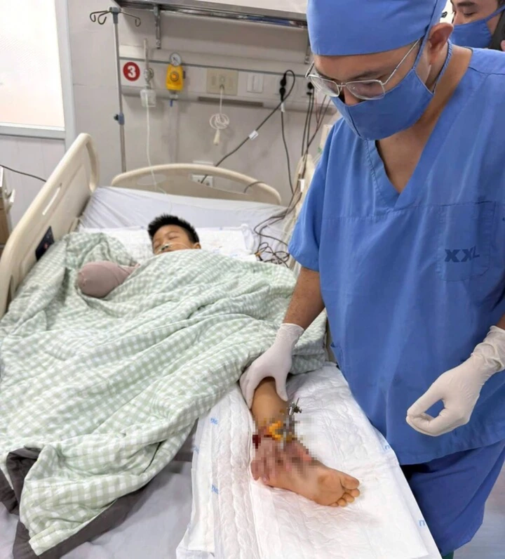 Cổng làng đổ sập đè bé trai 8 tuổi: Bác sĩ tạm nối bàn tay vào chân Cổng làng đổ sập đè bé trai 8 tuổi: Bác sĩ tạm nối bàn tay vào chân