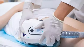 Công nghệ đông hủy mỡ có dùng được ở bắp tay? - Báo TinVina
