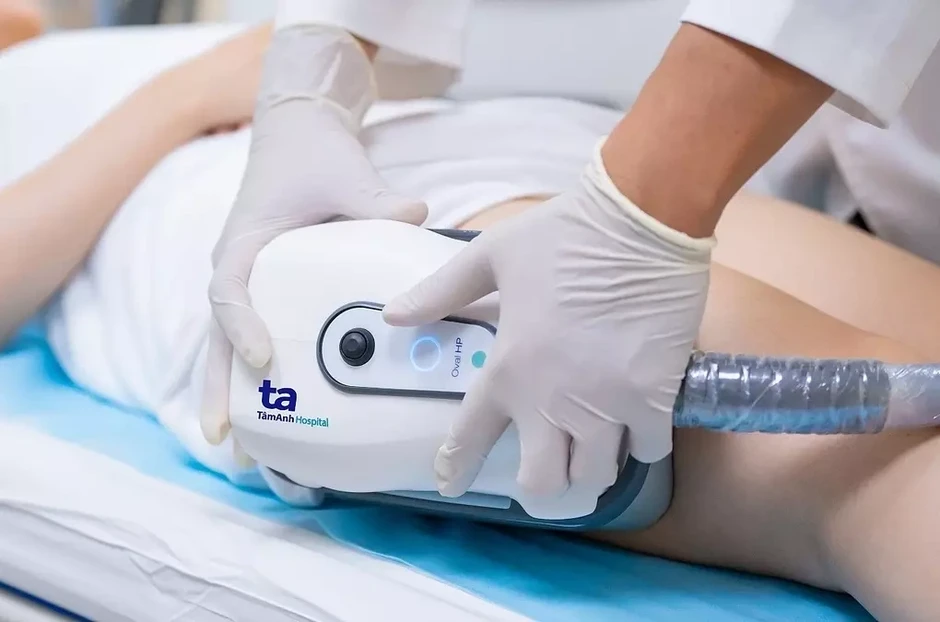 Công nghệ đông hủy mỡ có dùng được ở bắp tay? - Báo TinVina Công nghệ đông hủy mỡ có dùng được ở bắp tay? - Báo TinVina