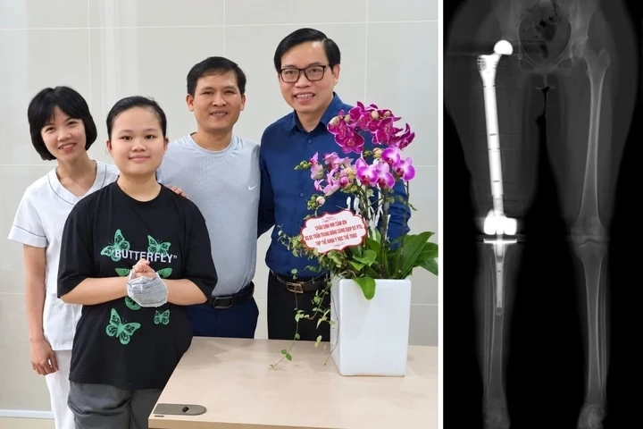 Cuộc hội ngộ đặc biệt giữa cô gái từng suýt mất chân và bác sĩ tại lễ khai giảng Cuộc hội ngộ đặc biệt giữa cô gái từng suýt mất chân và bác sĩ tại lễ khai giảng