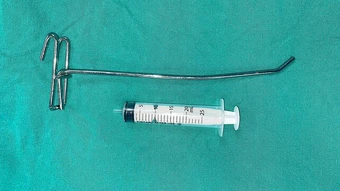 Cứu chàng trai bị thanh sắt đâm vào mắt