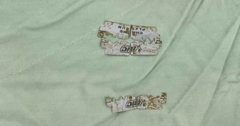 Cứu cô gái ở TPHCM nuốt 6 mảnh dao lam vào bụng