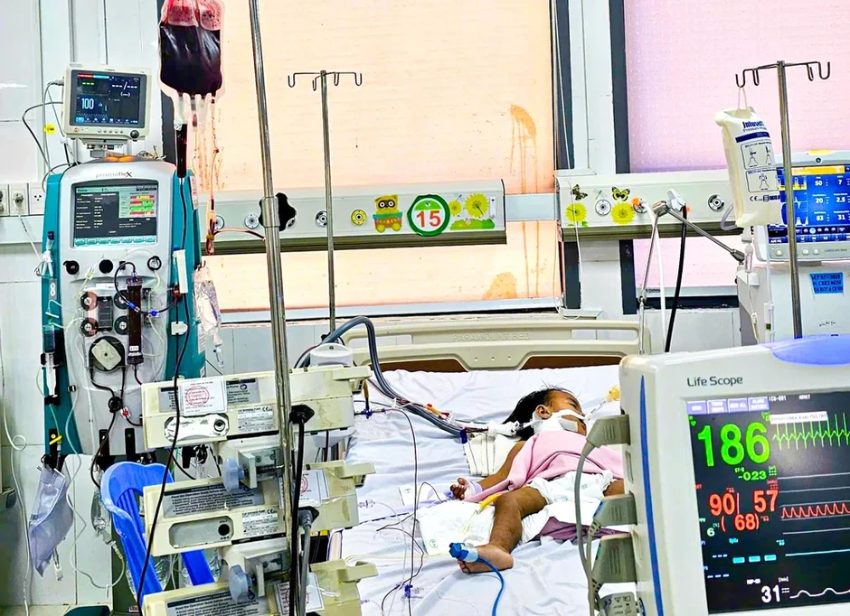 Cứu sống bé gái 20 tháng tuổi bị tay chân miệng độ 4 nguy kịch Cứu sống bé gái 20 tháng tuổi bị tay chân miệng độ 4 nguy kịch