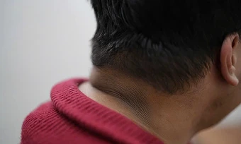 Da cổ, nách sậm màu có phải dấu hiệu tiểu đường? - Báo TinVina