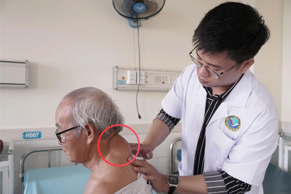 Đà Nẵng: Cụ ông mang khối u vùng cổ gáy suốt 40 năm Đà Nẵng: Cụ ông mang khối u vùng cổ gáy suốt 40 năm
