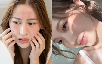 Da sạm nắng, sụt giảm collagen dù bôi kem chống nắng đầy đủ? Bác sĩ da liễu chỉ 5 lỗi sai cần tránh vào mùa hè