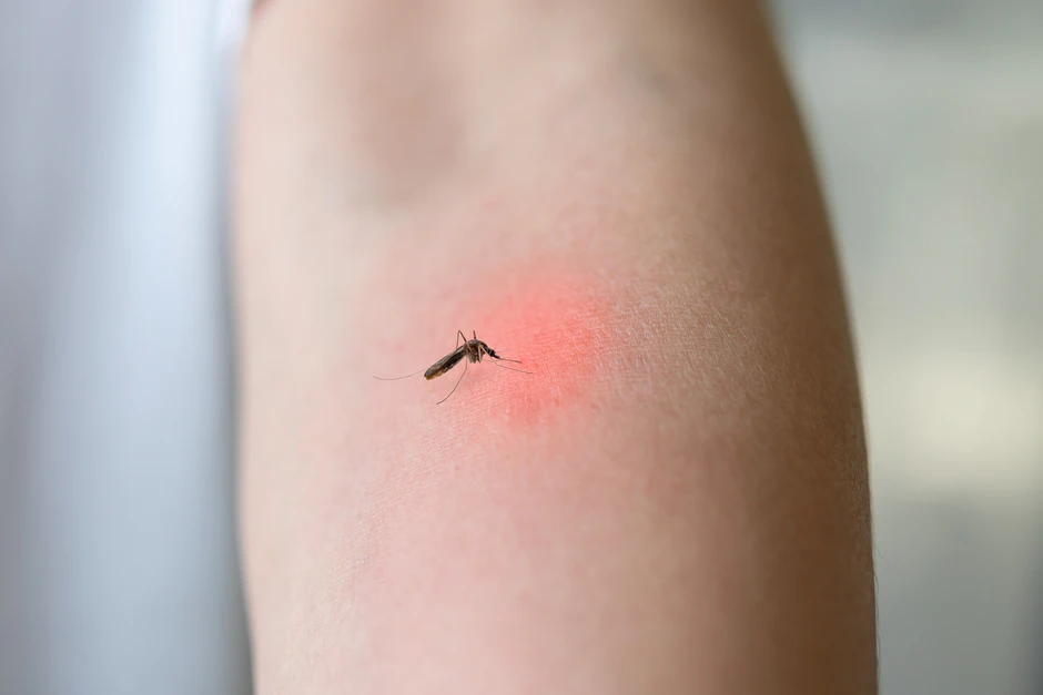 Đã tiêm từ nhỏ, vì sao trẻ cần rà mũi nhắc viêm não Nhật Bản? Đã tiêm từ nhỏ, vì sao trẻ cần rà mũi nhắc viêm não Nhật Bản?