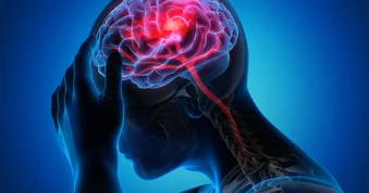 Đang đi mà thấy dấu hiệu này, cẩn thận kẻo đột quỵ đã "gõ cửa"
