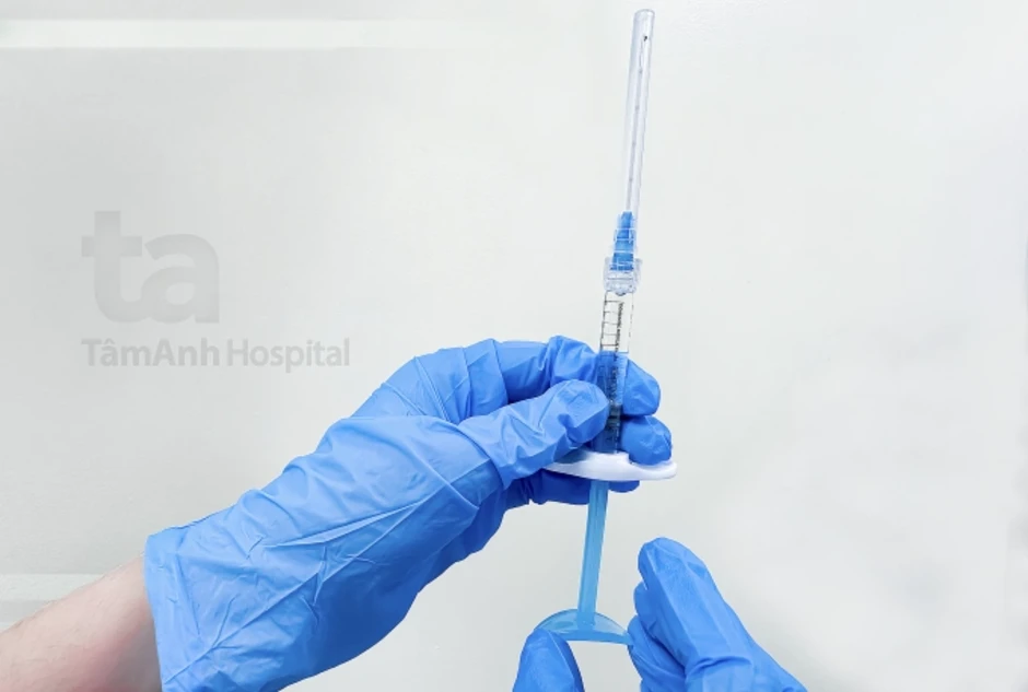 Đang niềng răng có tiêm filler được không? - Báo TinVina Đang niềng răng có tiêm filler được không? - Báo TinVina