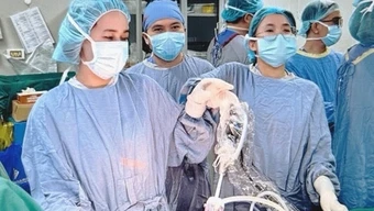 Đau bụng âm ỉ, người đàn ông đi khám phát hiện cùng lúc mắc 2 loại ung thư