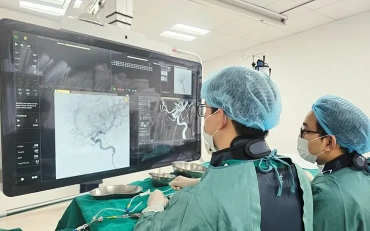 Đau đầu kéo dài, phát hiện túi phình mạch não nguy hiểm Đau đầu kéo dài, phát hiện túi phình mạch não nguy hiểm